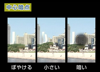 入院について 中心