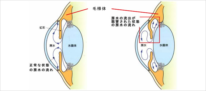 眼圧検査